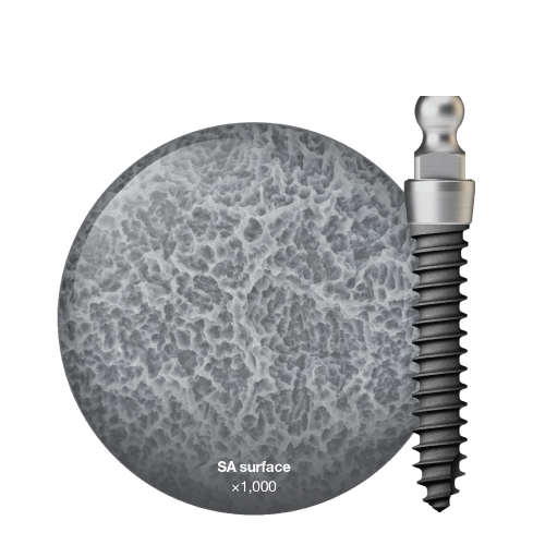 denture-implant-edentulous.png